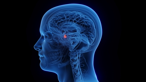 Incidentaloma hipofisário: critérios de diagnóstico e conduta